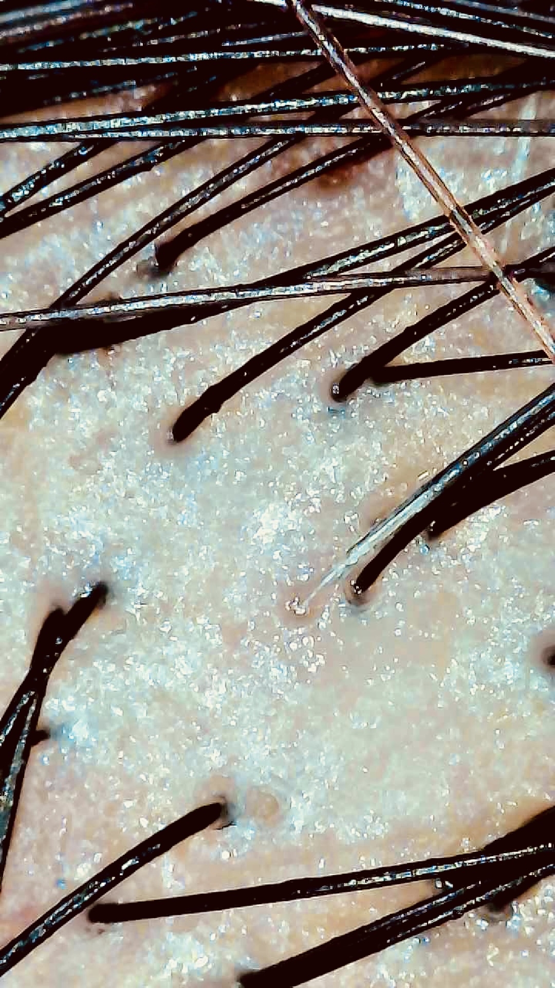 頭皮